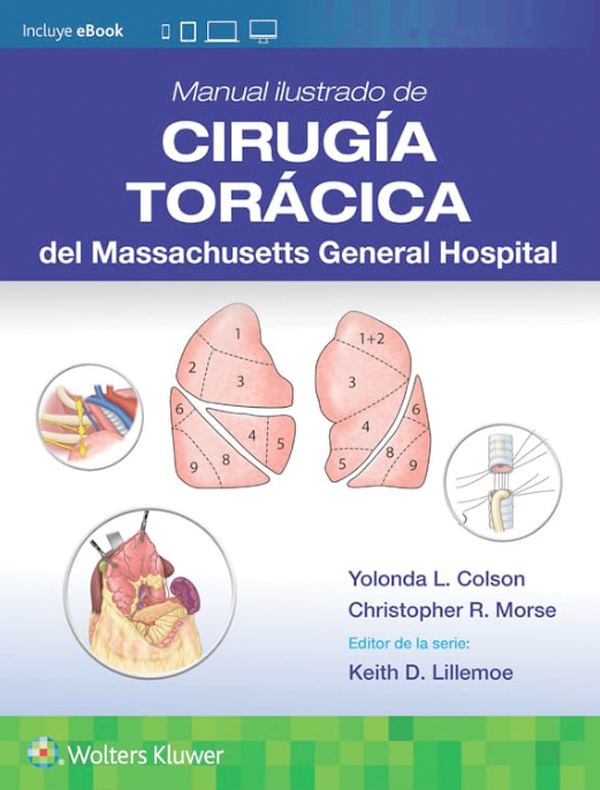 Manual ilustrado de Cirugía torácica del Massachusetts Hosp.-4