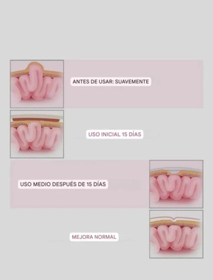 Faja cinturón de hernia umbilical para bebe 00107-5