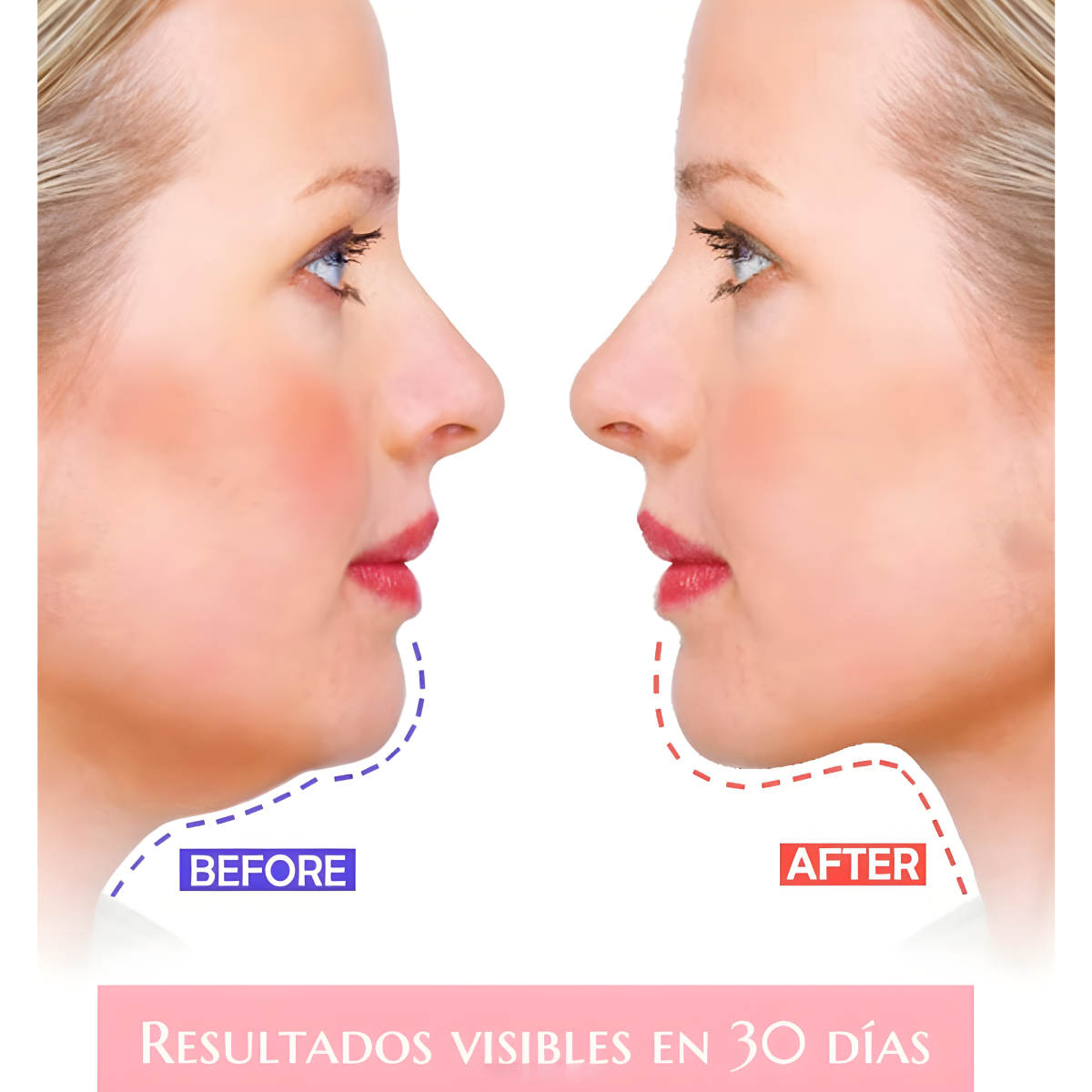 Faja Almohadilla Facial Reductora De Papada Levantamiento-3