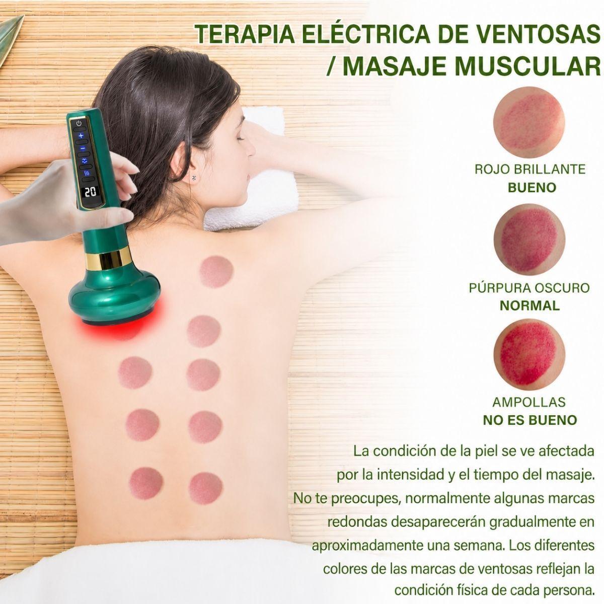 Masajeador De Ventosas Inteligente Con Calor Y Succion-2