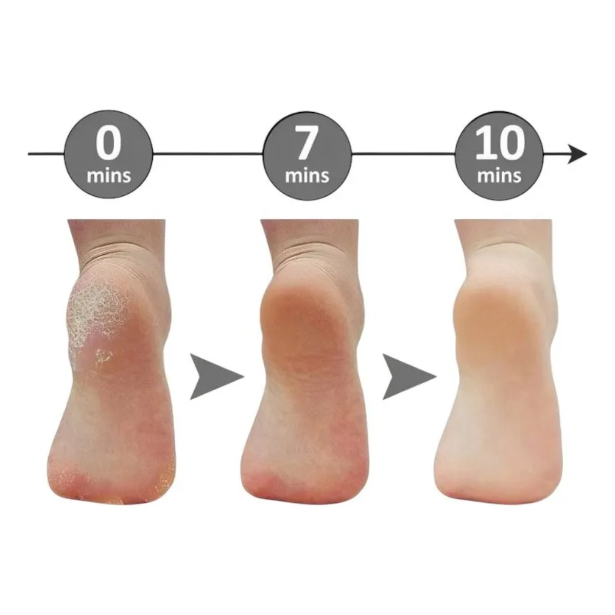 Removedor Callos Lima Electrica Para Pies Recargable 2 En 1-7