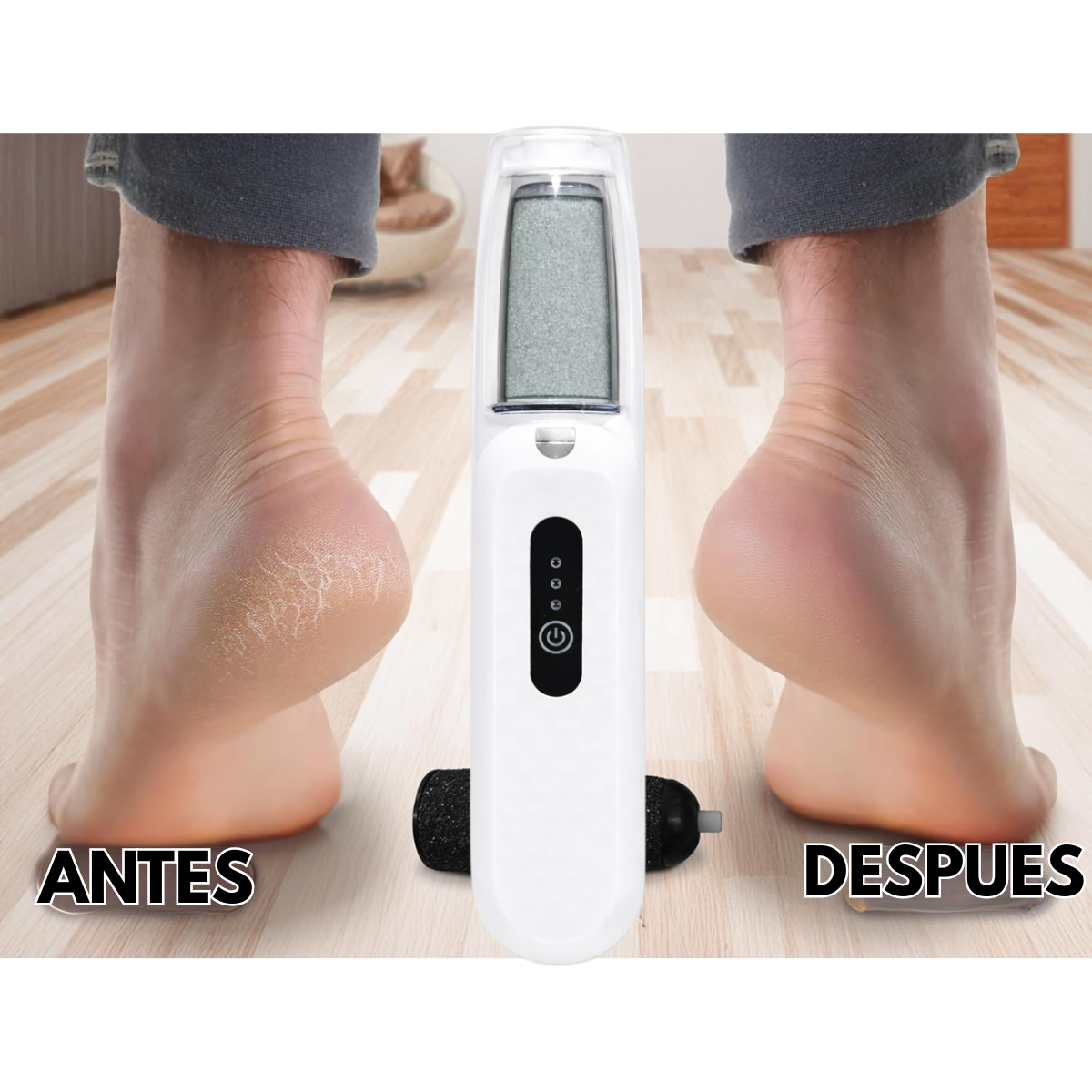 Removedor Callos Lima Electrica Para Pies Recargable 2 En 1-2