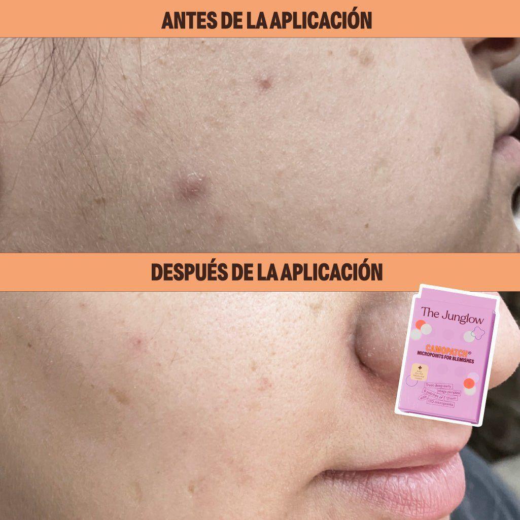 Micropoints The Junglow Antiimperfecciones-3
