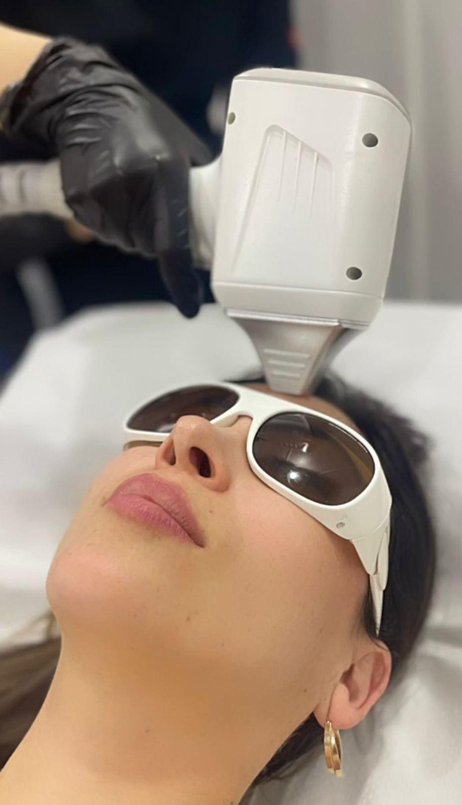 depilación Láser-0