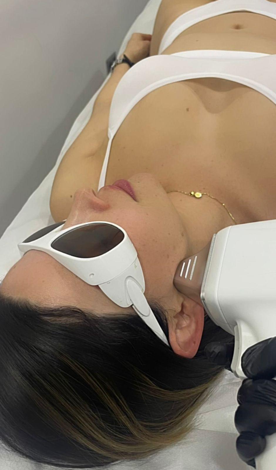 depilación Láser-1