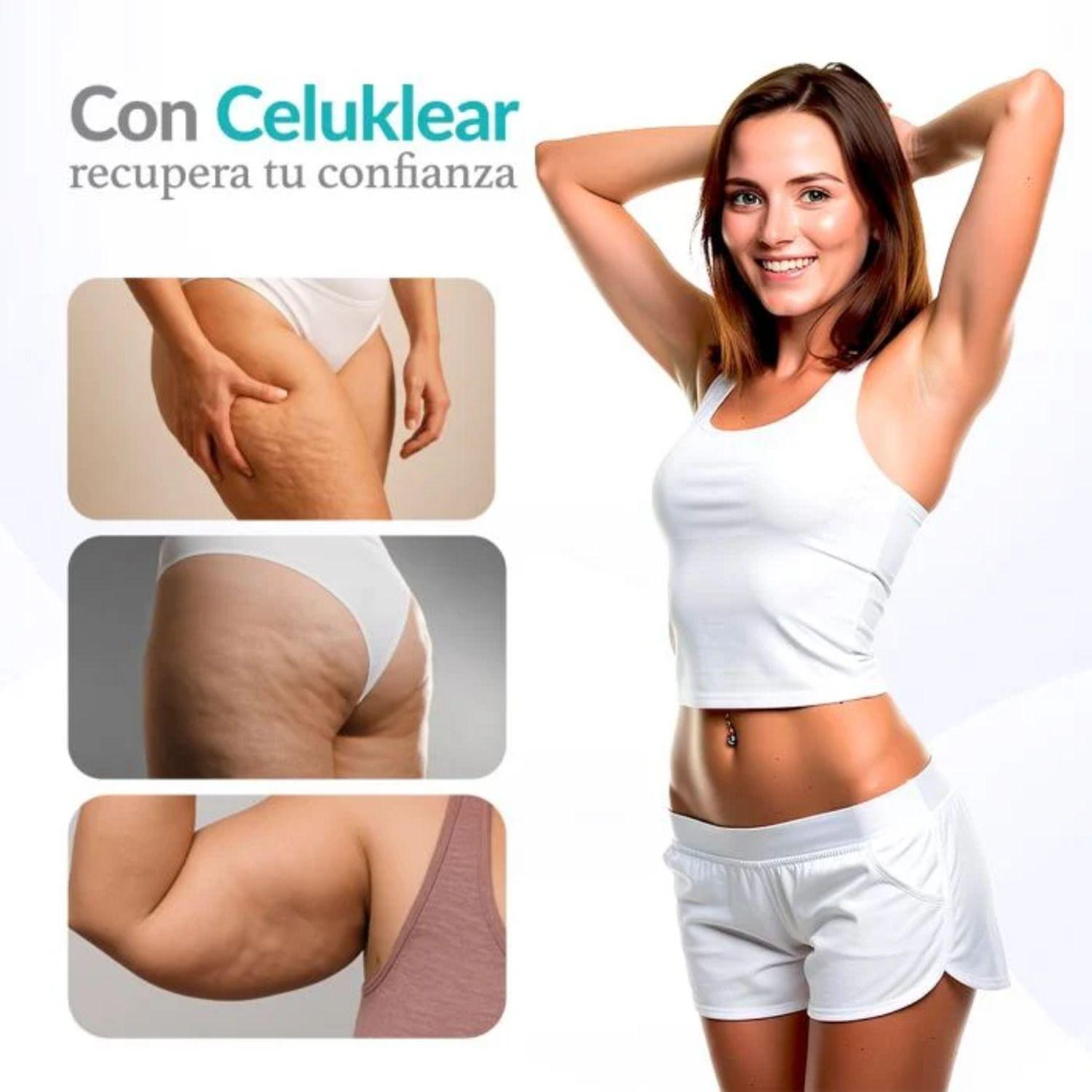 Masajeador Anticelulitis Celuklear 3 en 1-4