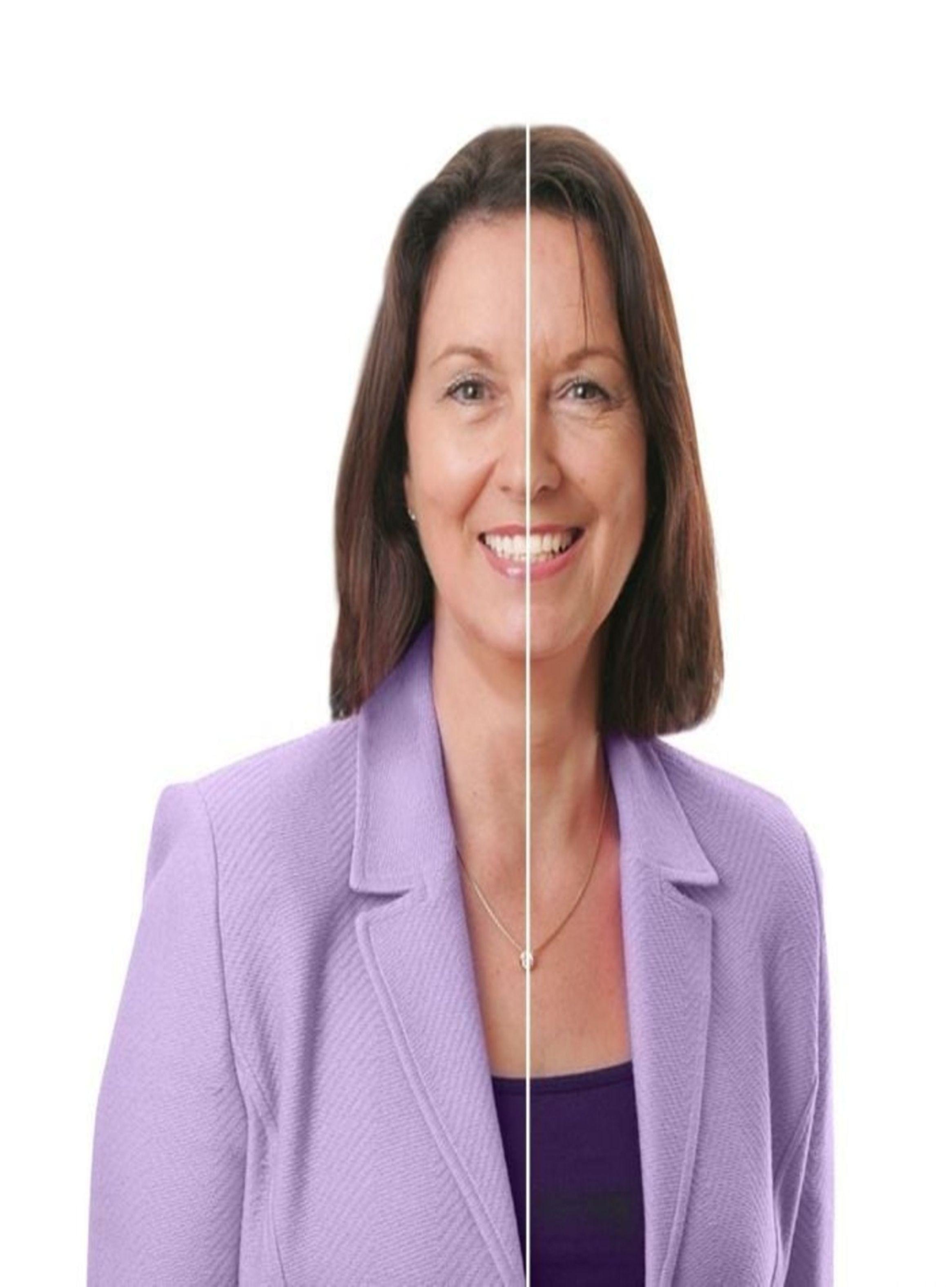 Removedor de Arrugas Instantáneo Lishe-3