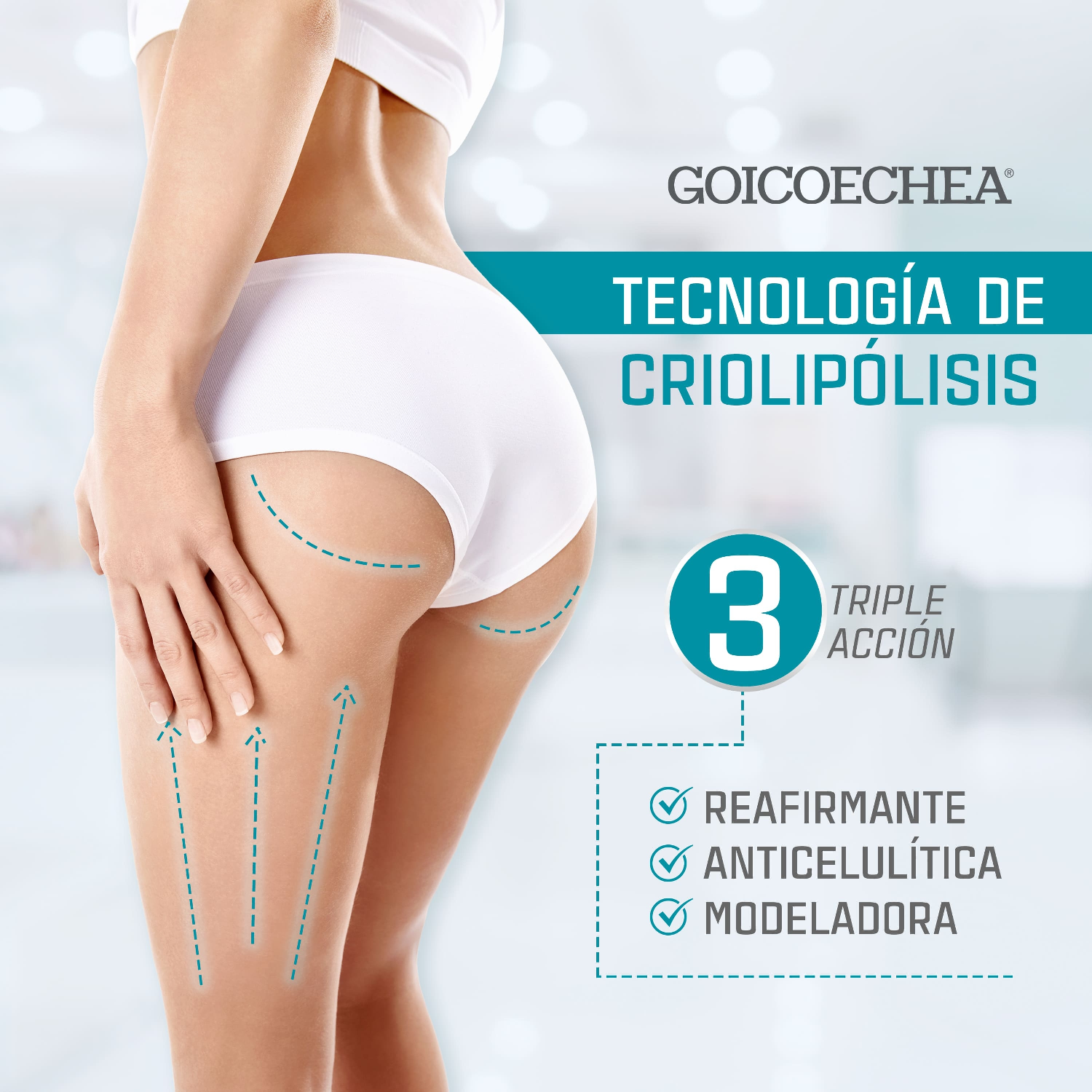 Goicoechea Criogel 3D 200ML-3