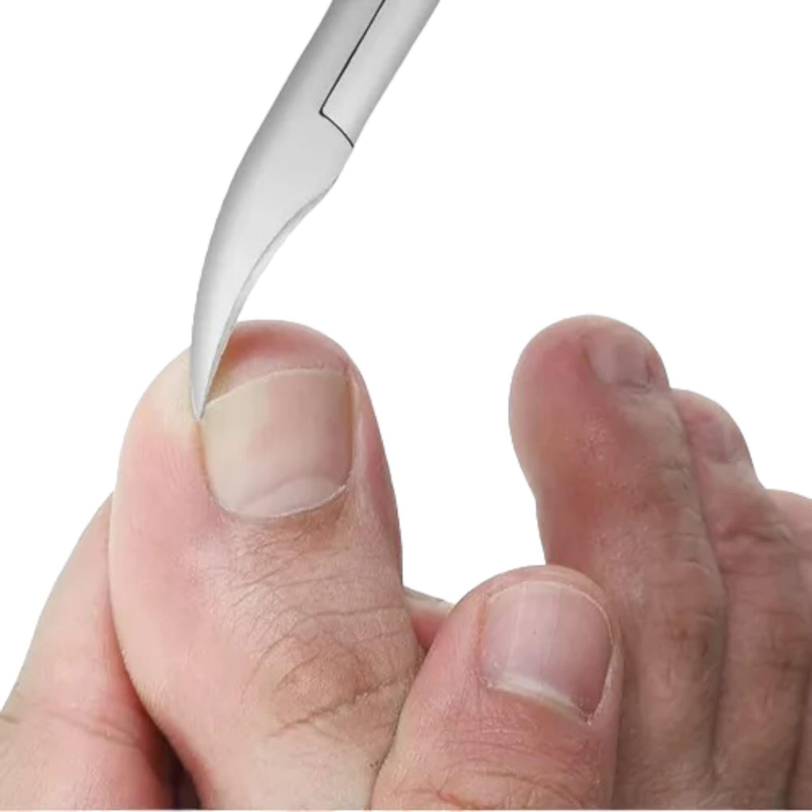 Cortauñas Dedo Del Pie Uñas Encarnadas O Gruesas -2