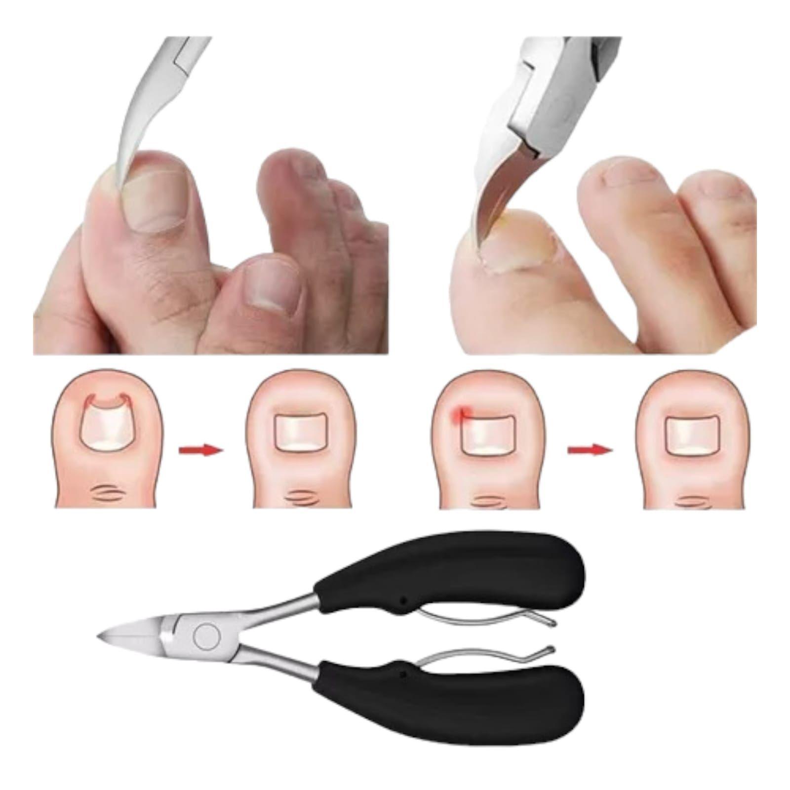 Cortauñas Dedo Del Pie Uñas Encarnadas O Gruesas -3