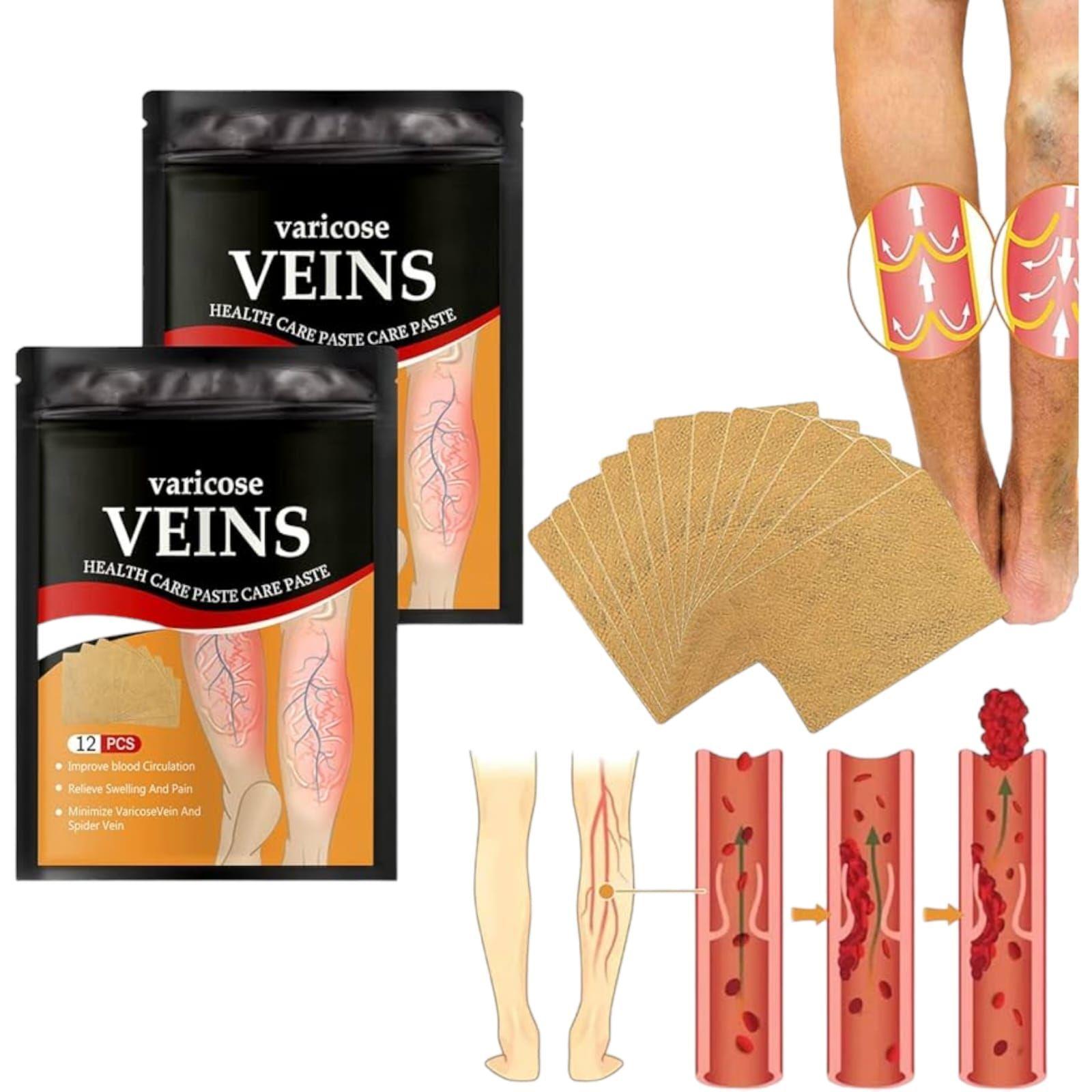 Parche De Pierna Para Tratamiento De Venas Varicosas-2