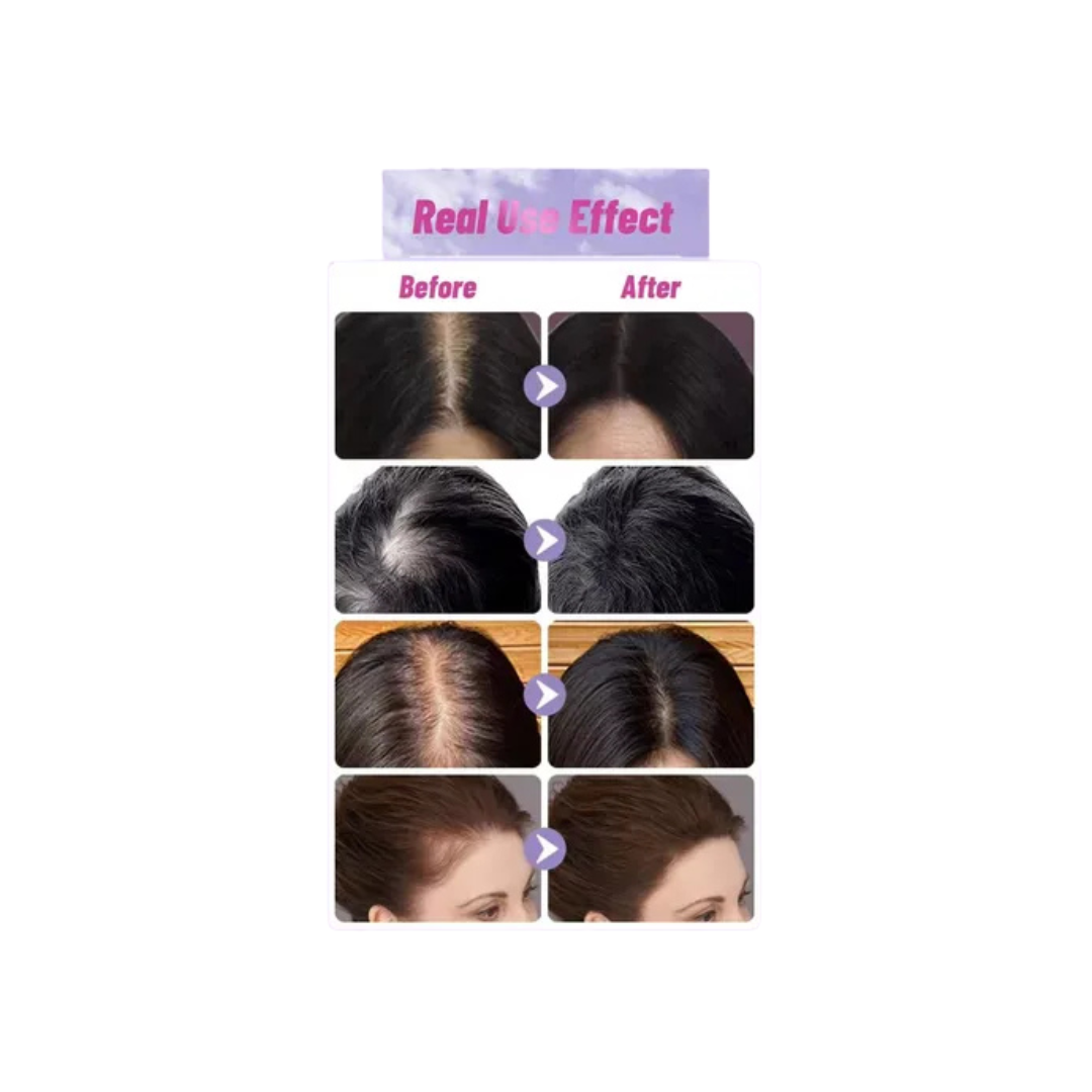 Shampoo Y Acondicionador De Cebolla Alopecia Kit Anticaída-1