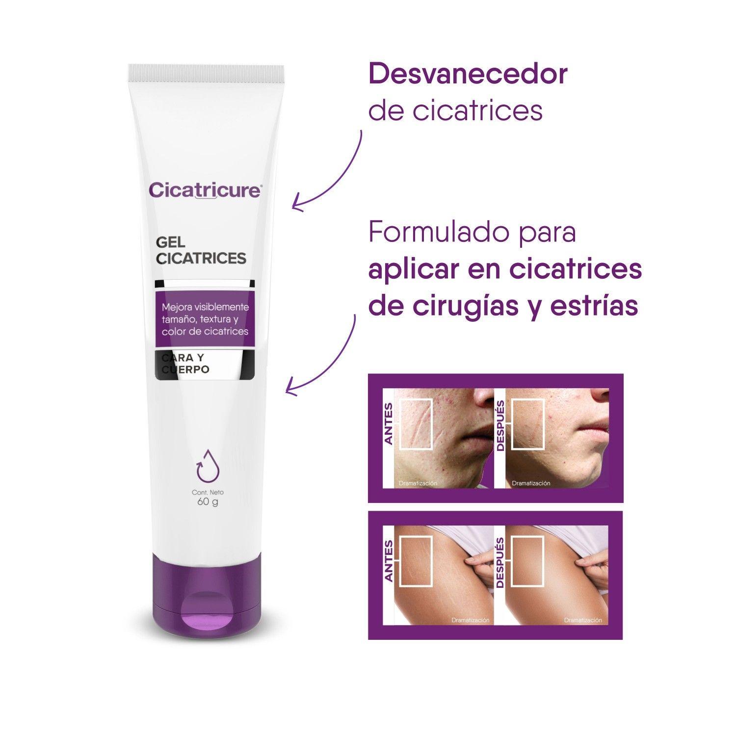 Cicatricure Gel Cicatrices Y Estrías 60 G-5
