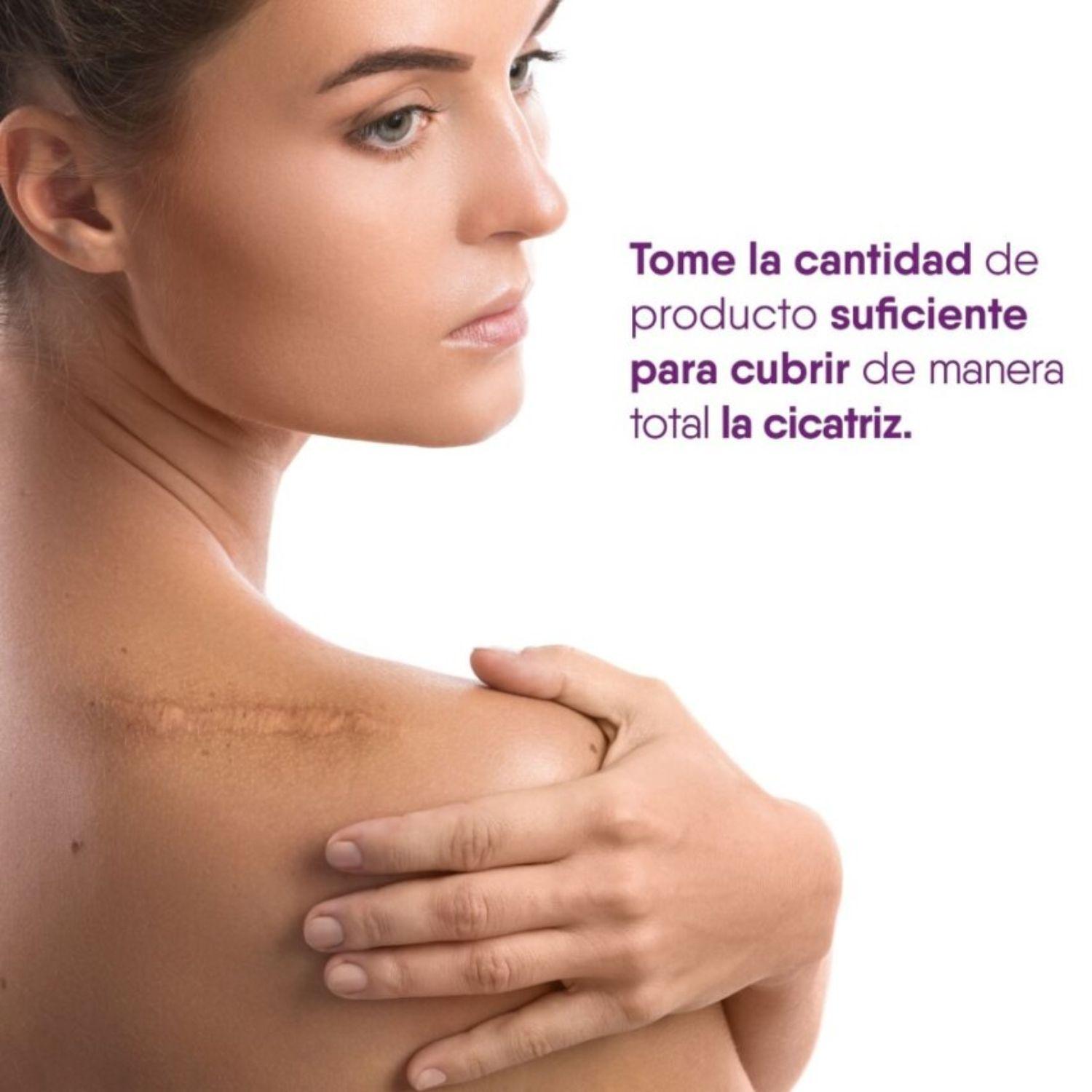 Cicatricure Gel Cicatrices Y Estrías 30 G-6