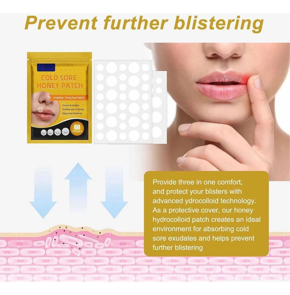 Parches Para El Herpes Labial Parches De Miel E Hidrocoloide-2