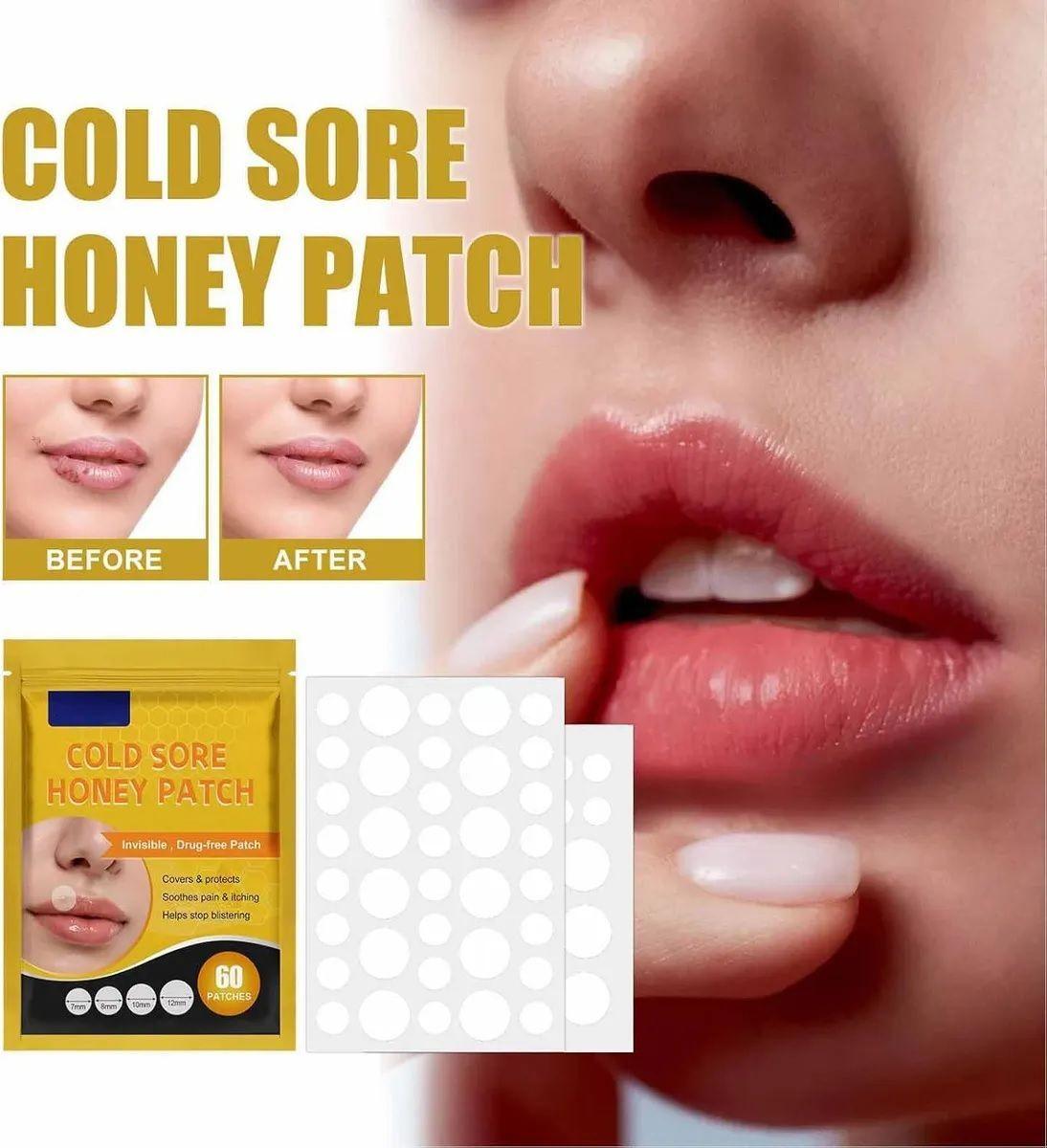 Parches Para El Herpes Labial Parches De Miel E Hidrocoloide-4