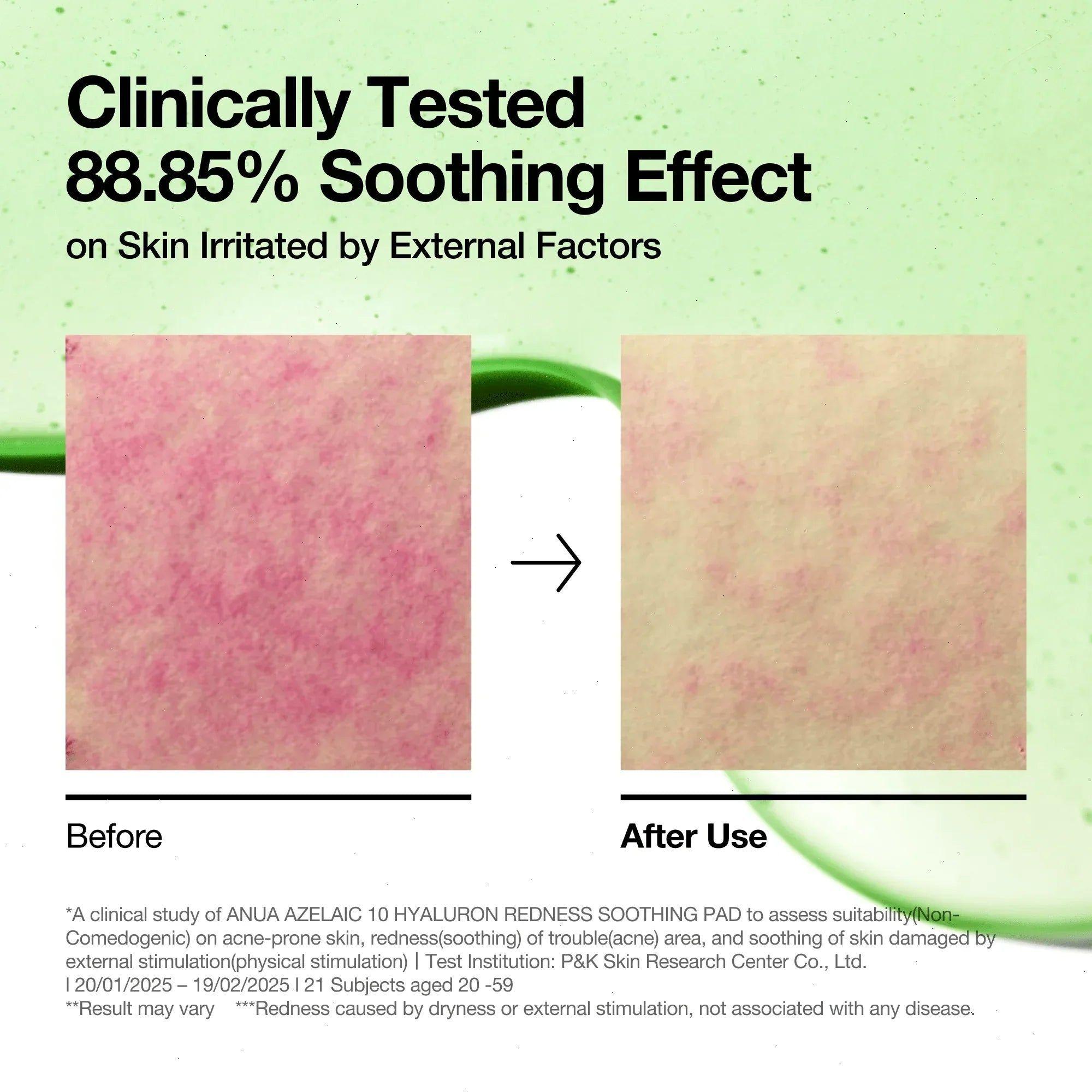ANUA Soothing Pad Azelaic 10 Hyalyron-3