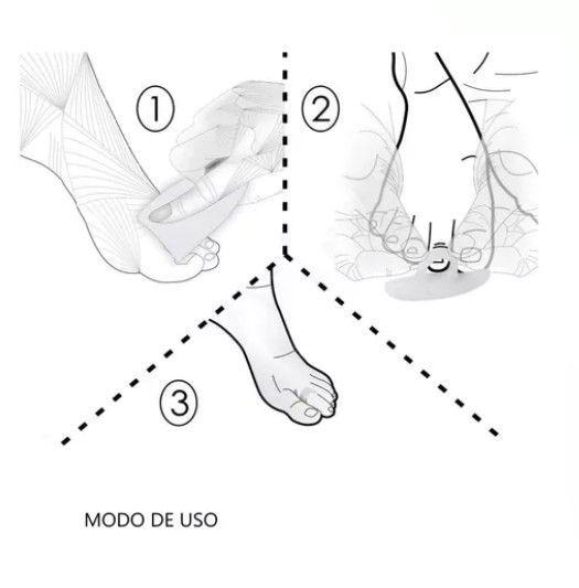 Almohadilla Corrector De Silicona Para Dedo Martillo O Garra-4