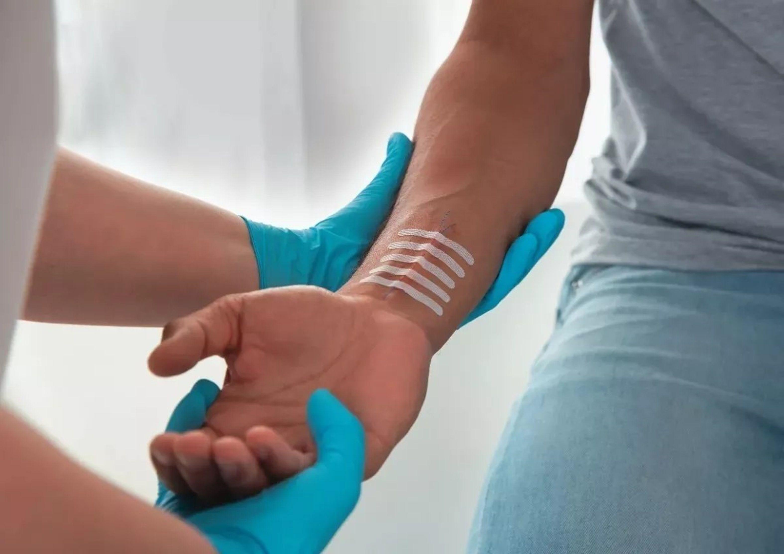 Leukosan Strip 6 X 75mm Pack De 1 Sobre X 3 Unds-2