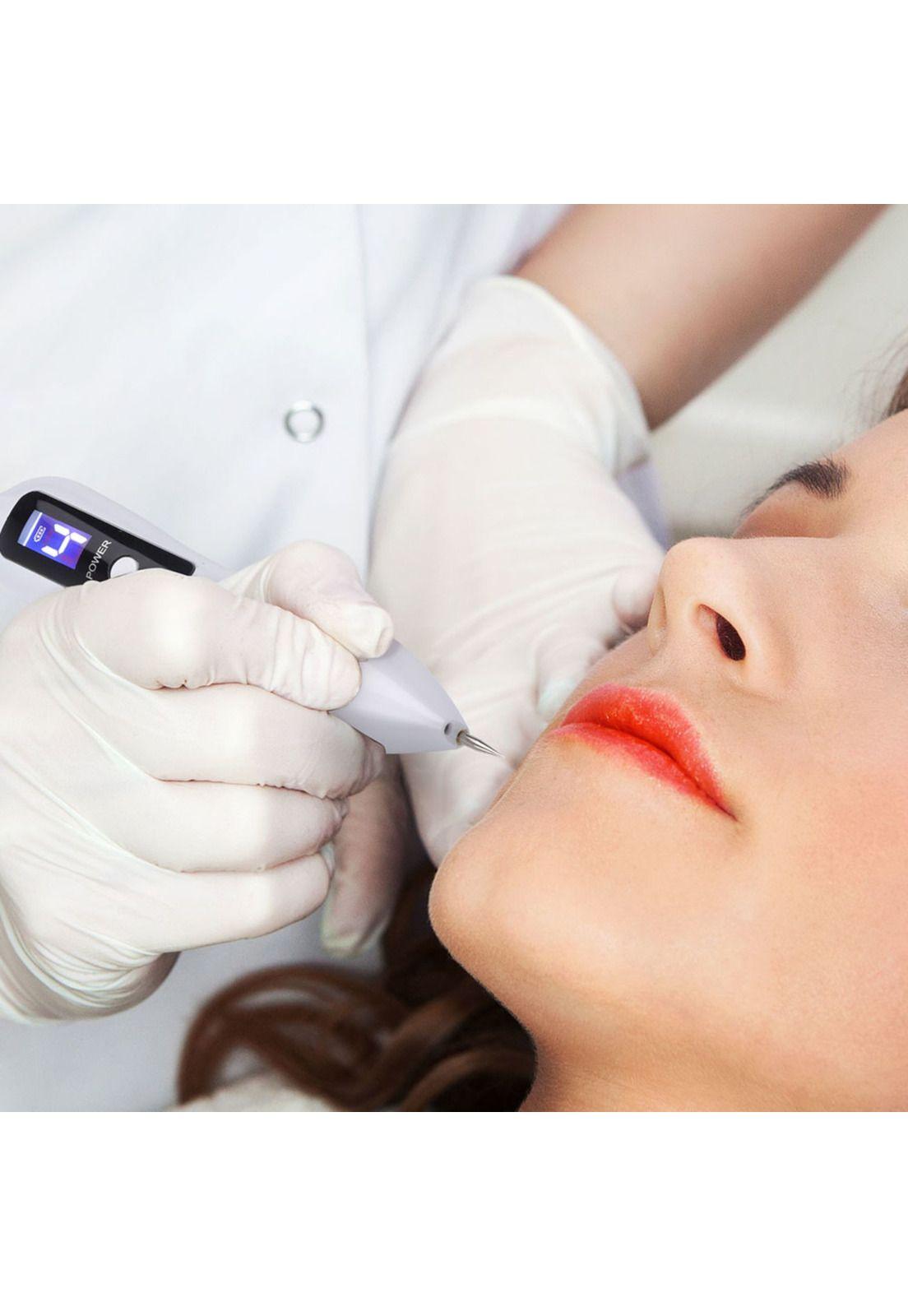 Laser Pen Removedor Plasma Maquina Extracción Verrugas Manchas Lunares Pecas-4