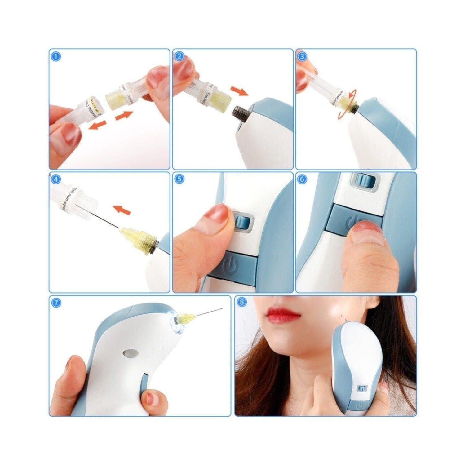 Plasma Pen Profesional Maglev-3