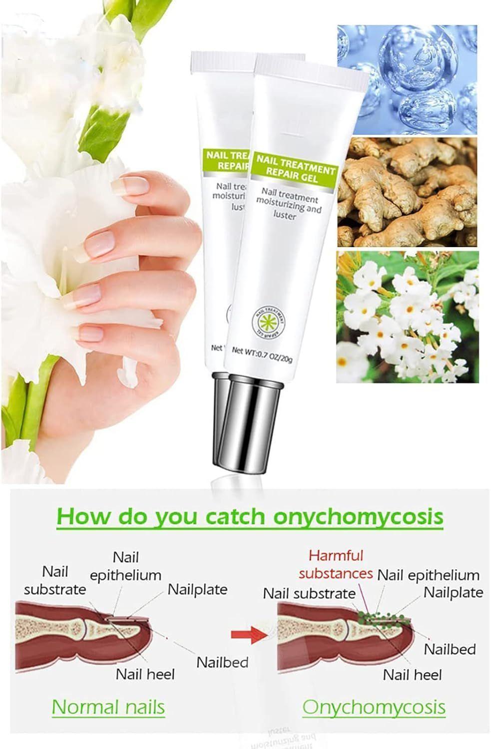 Crema de reparación de uñas antifúngica hongos (1 pieza, 20g)-4