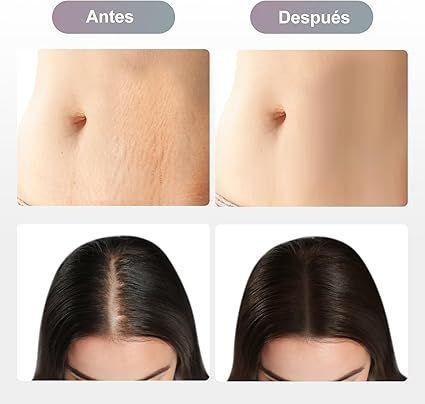 Dermapen M8 Inalámbrico10 Agujas.-6