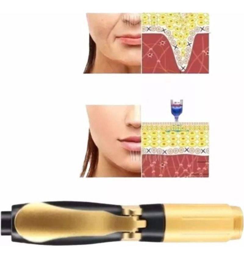 Hyaluron Pen lápiz Hialuronico De Alta Precisión 03 Y 05-6