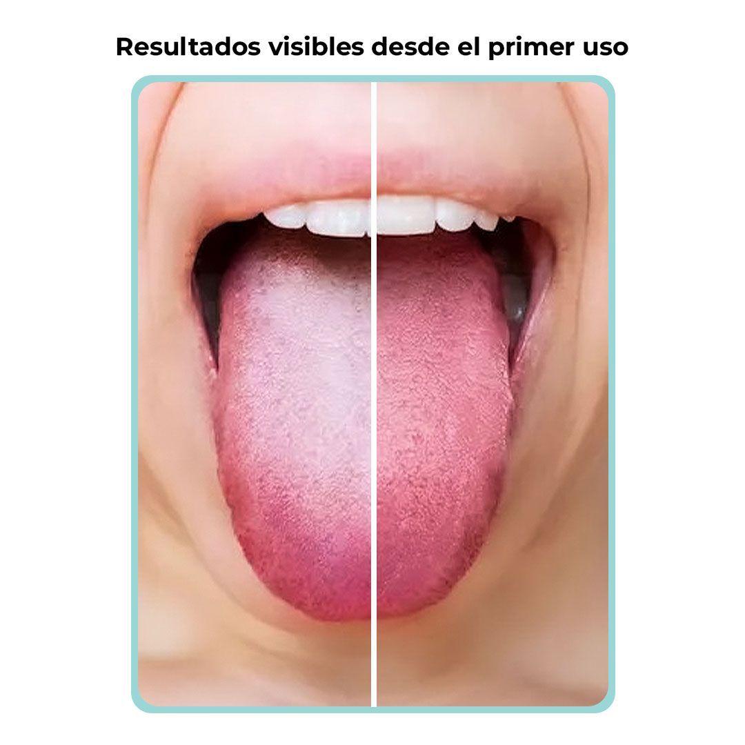 Limpiador De Lengua De Acero Inoxidable Cuidado Bucal Boca-3