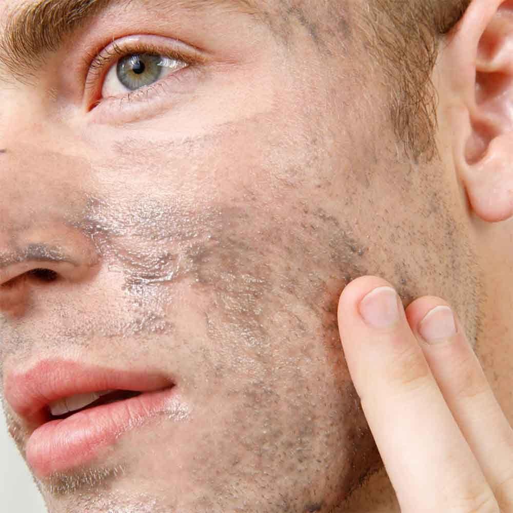 Exfoliante Facial de Carbón Detox-2