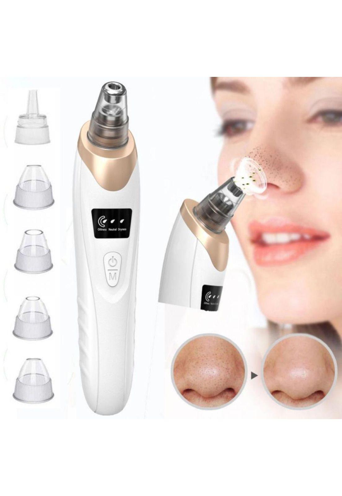 Removedor Puntos Negros Extractor De Espinillas Facial Usb-1