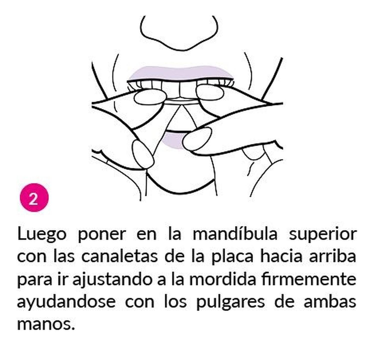 Anti Bruxismo Placa Mandibular Drimwell Original - Bruxismo-5