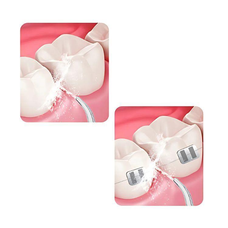 Limpiador Dental Portatil USB Irrigador Bucal-5