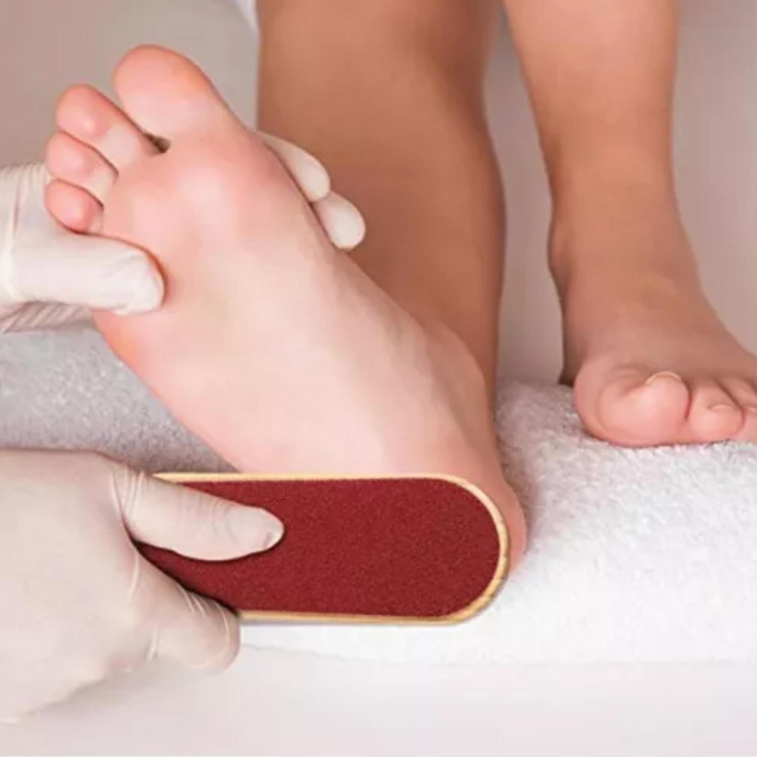 Lima Quita Durezas Removedor De Callos Pies Paletas-4