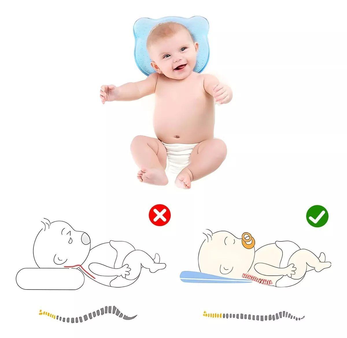 Almohada Para Bebé Cojín Anti-plagiocefalia Cabeza Plana-4