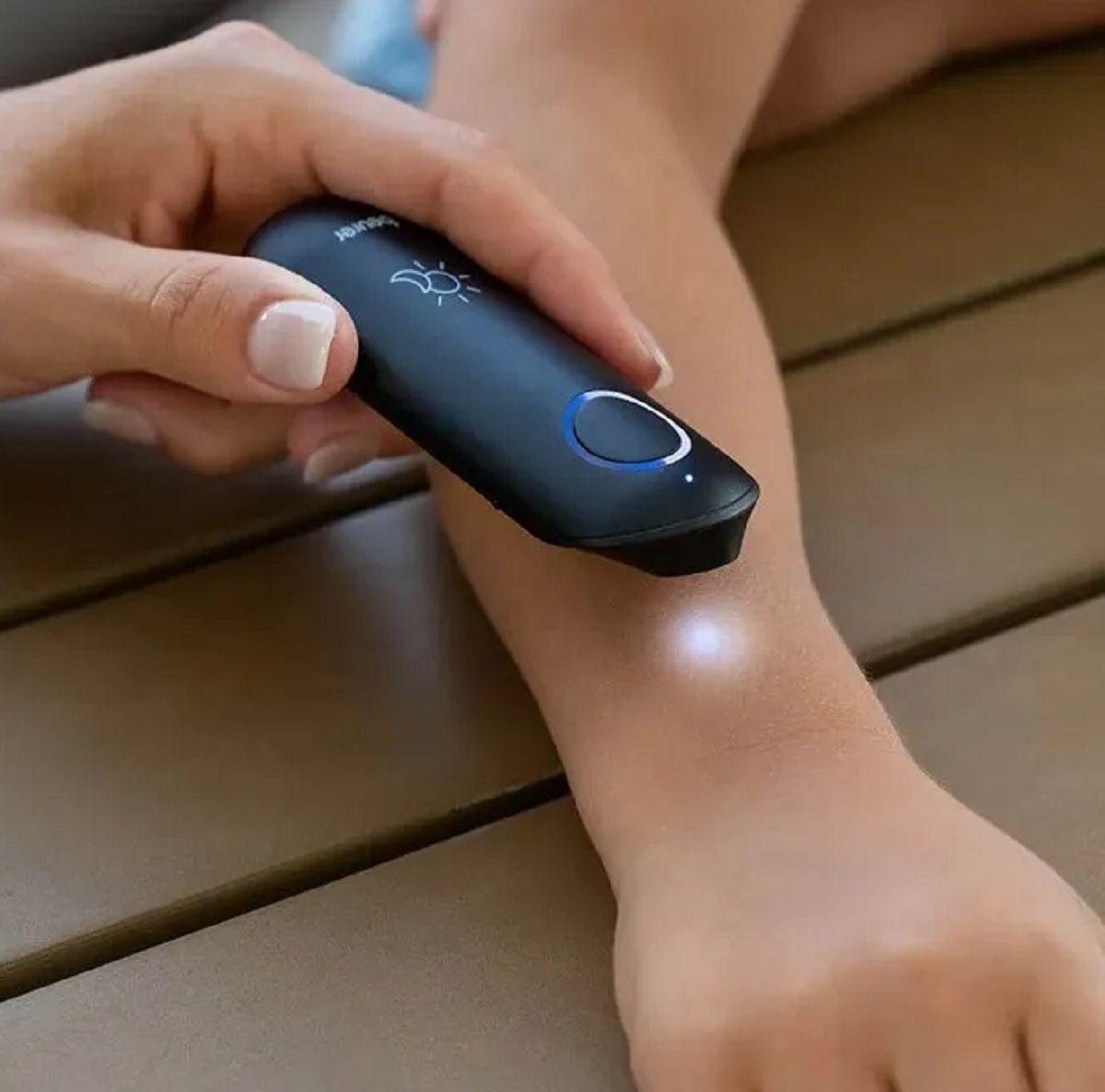 Aparato Sanador De Picaduras Insectos Mosquitos Beurer Br 90-2