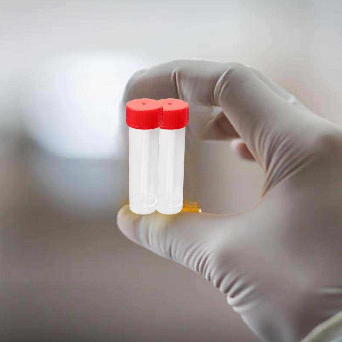 RECOLECTOR DE MUESTRA ORINA 30 ML LABORATORIO LAU -5