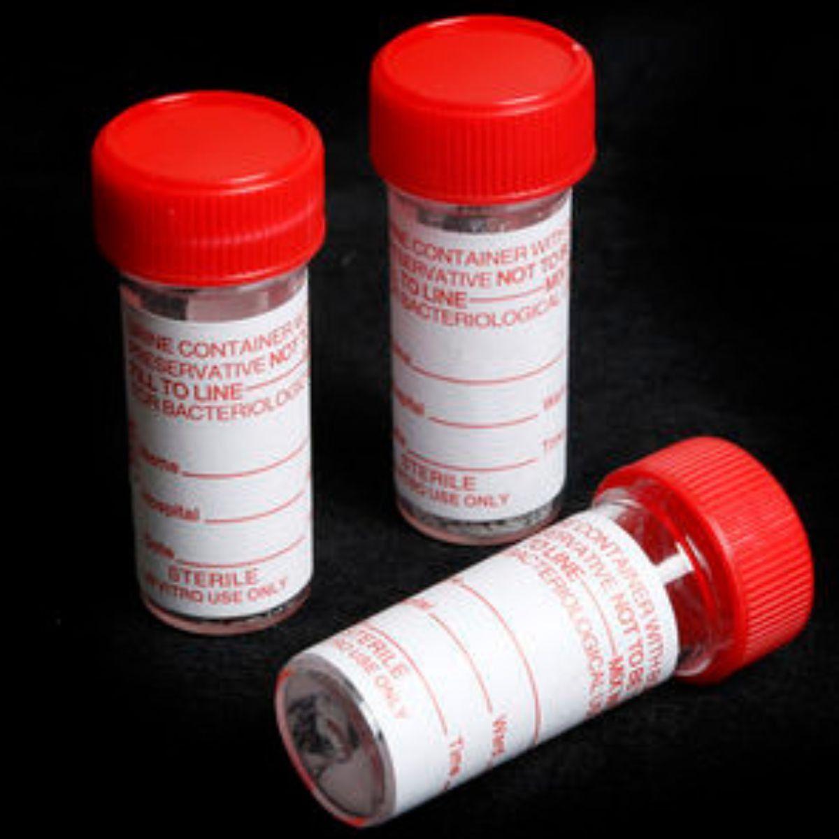 RECOLECTOR DE MUESTRA ORINA 30 ML LABORATORIO LAU -8