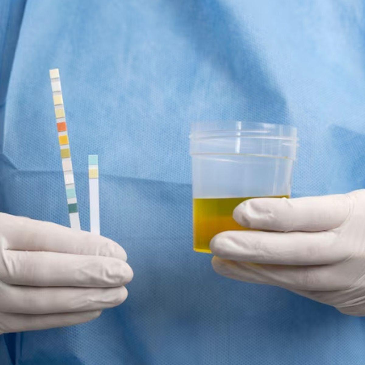 PAQUETE RECOLECTOR DE HECES MUESTRA LABORATORIO LAU-5