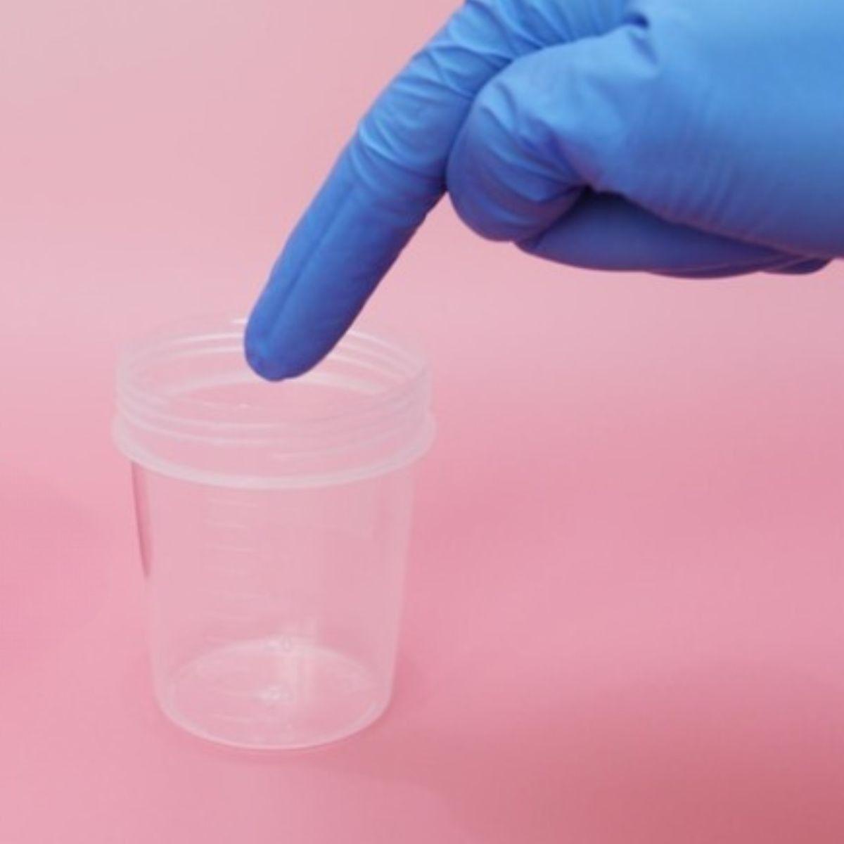 PAQUETE RECOLECTOR DE HECES MUESTRA LABORATORIO LAU-7