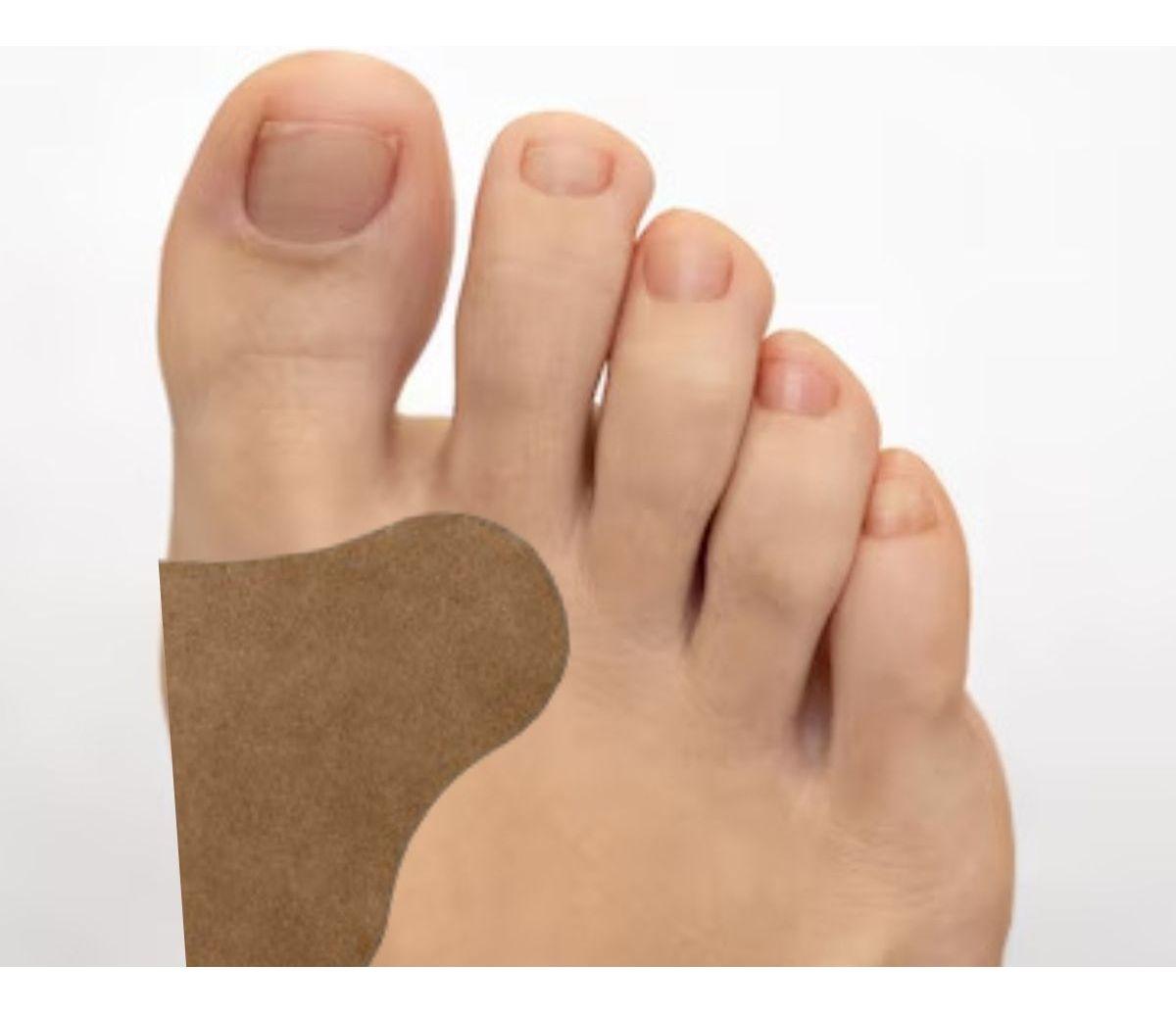 SET 8 PACK PARCHES ANTI JUANETE ALIVIAR DOLOR ARTICULAR LAU-1