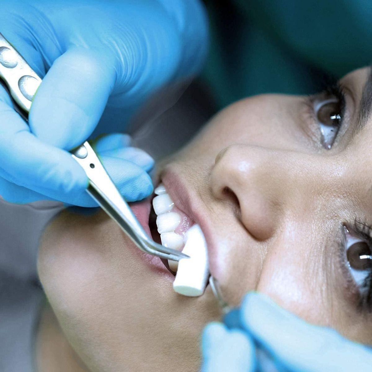 ALGODÓN HIDROFILICO DENTAL PACK DE 50 UNIDADES LAU-1