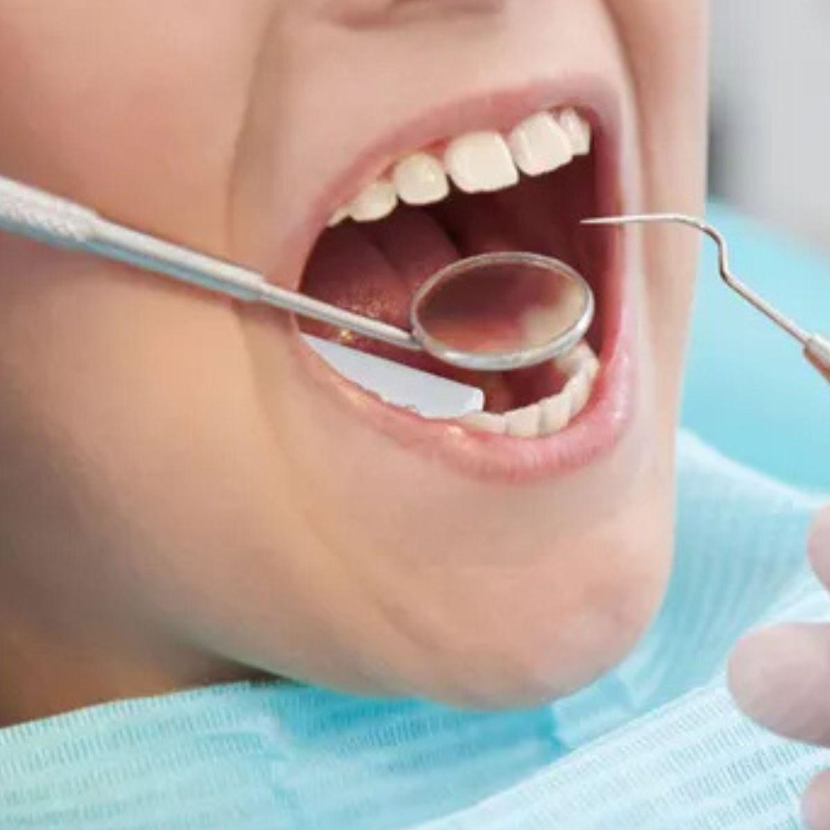 ALGODÓN HIDROFILICO DENTAL PACK DE 50 UNIDADES LAU-2