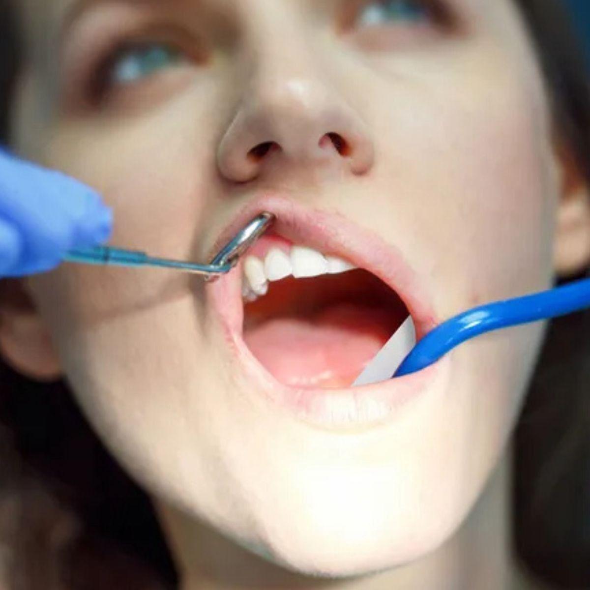 ALGODÓN HIDROFILICO DENTAL PACK DE 50 UNIDADES LAU-5