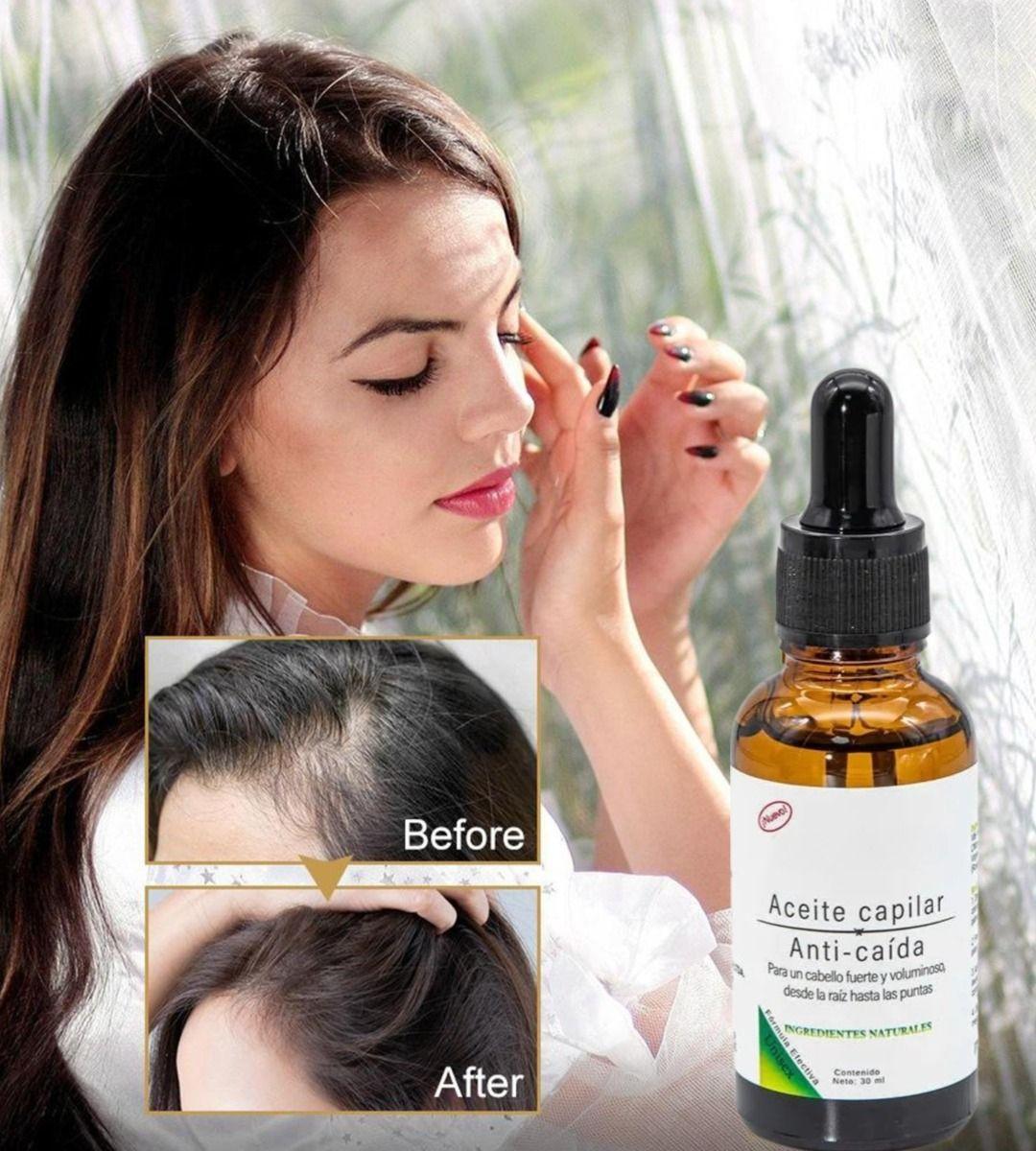 Set 3 Serum Aceite Capilar Anticaida Estimulante Cabello Jhn-4