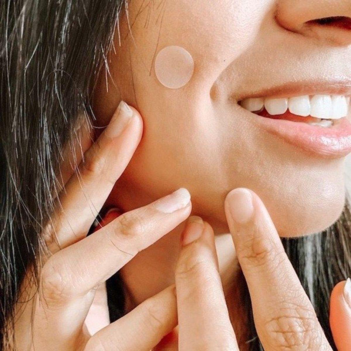 SET 2 PARCHES PARA ACNE HIDROCOLOIDES TODO PIEL LAU-2