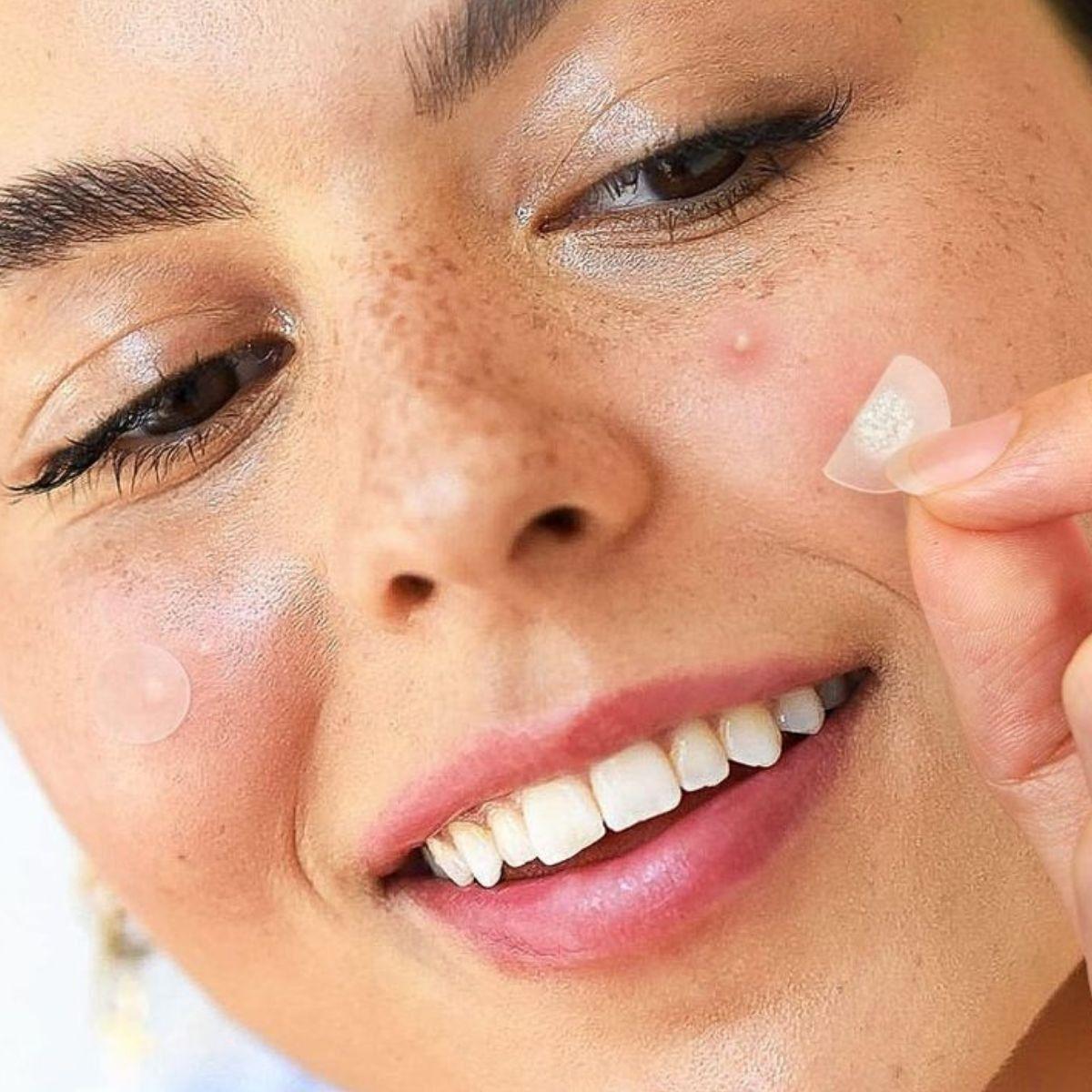 SET 2 PARCHES PARA ACNE HIDROCOLOIDES TODO PIEL LAU-4