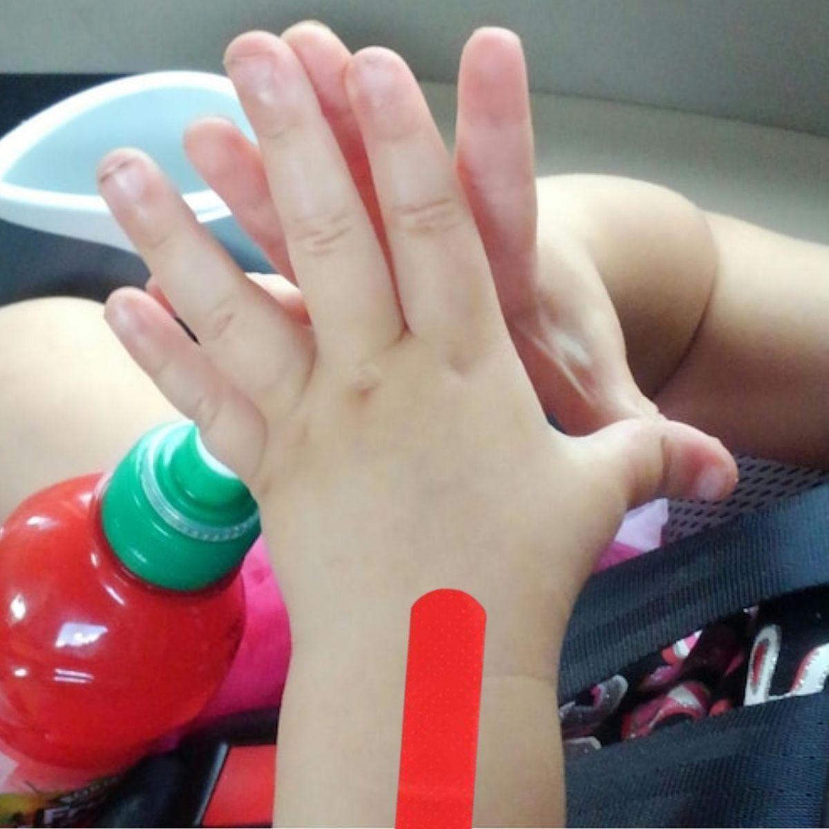 PACK 5 PARCHES CURITAS INFANTIL HERIDAS COLORES LAU-7