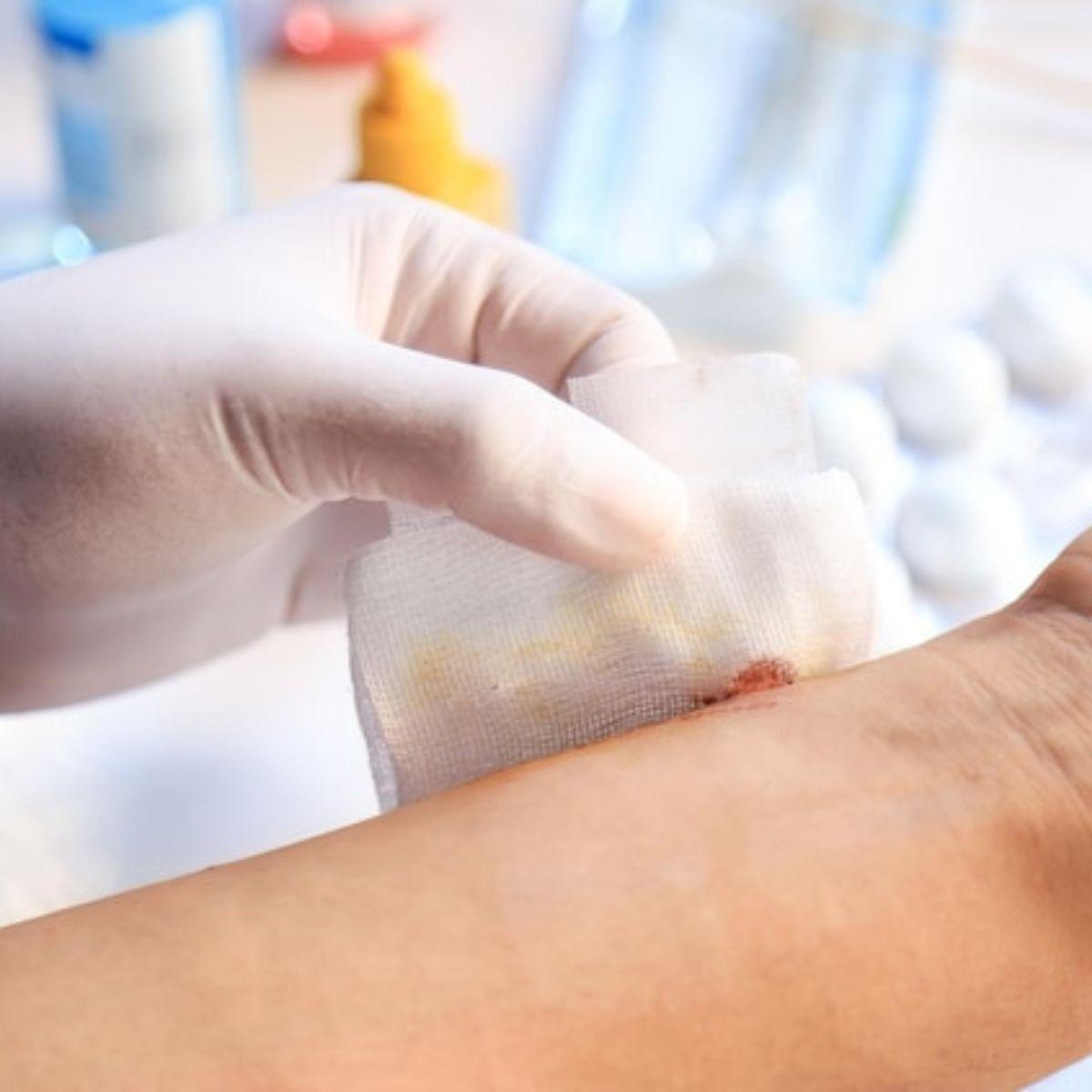 PACK 6 GASAS ESTERIL 90CMX90CM INSUMO MEDICO HERIDA LAU-7