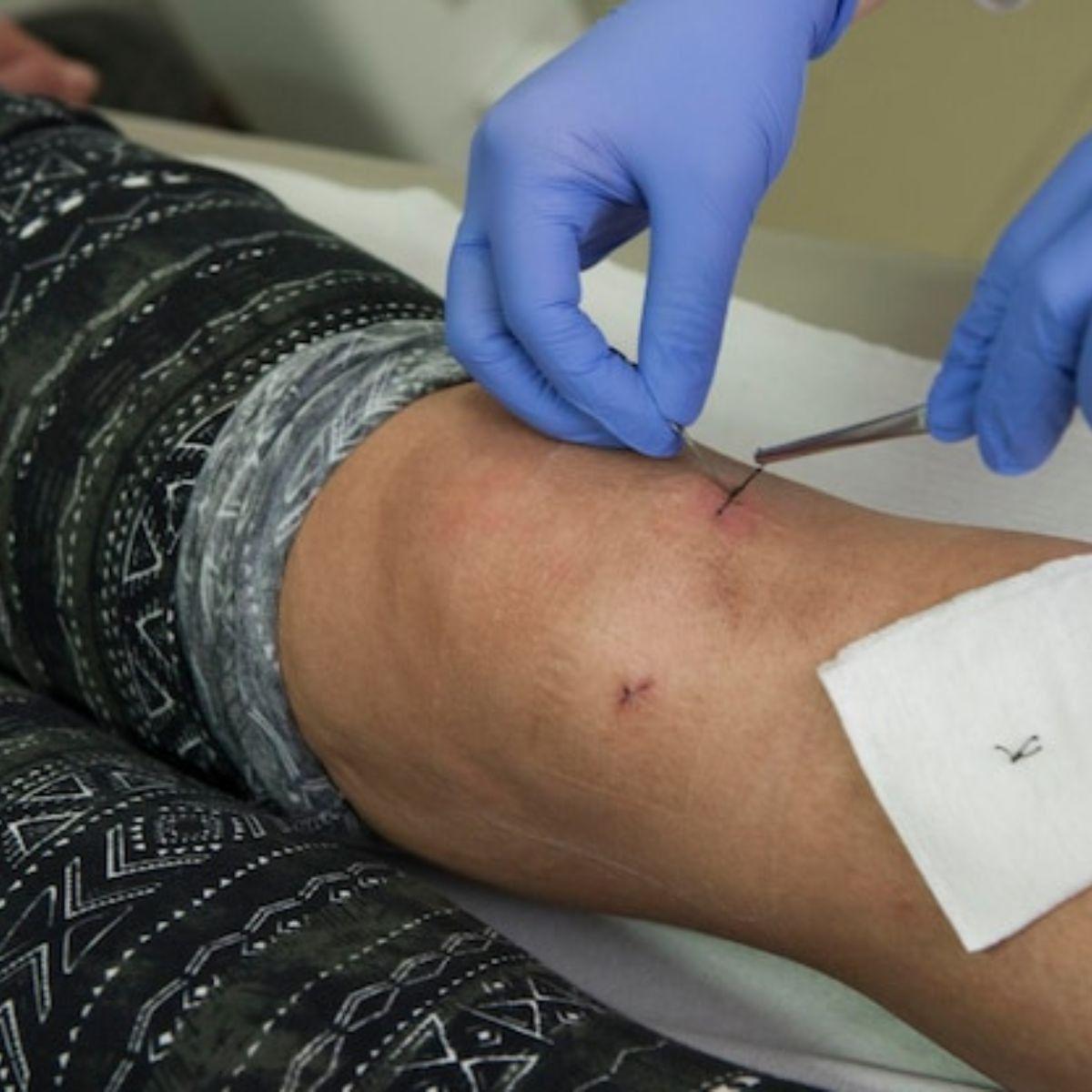 PACK 6 GASAS ESTERIL 90CMX90CM INSUMO MEDICO HERIDA LAU-9